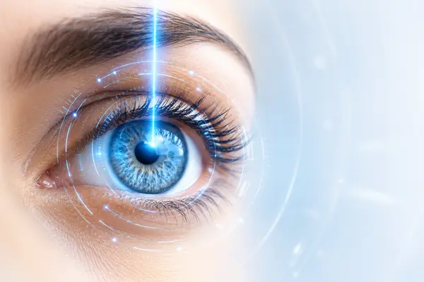 Αστιγματισμός laser